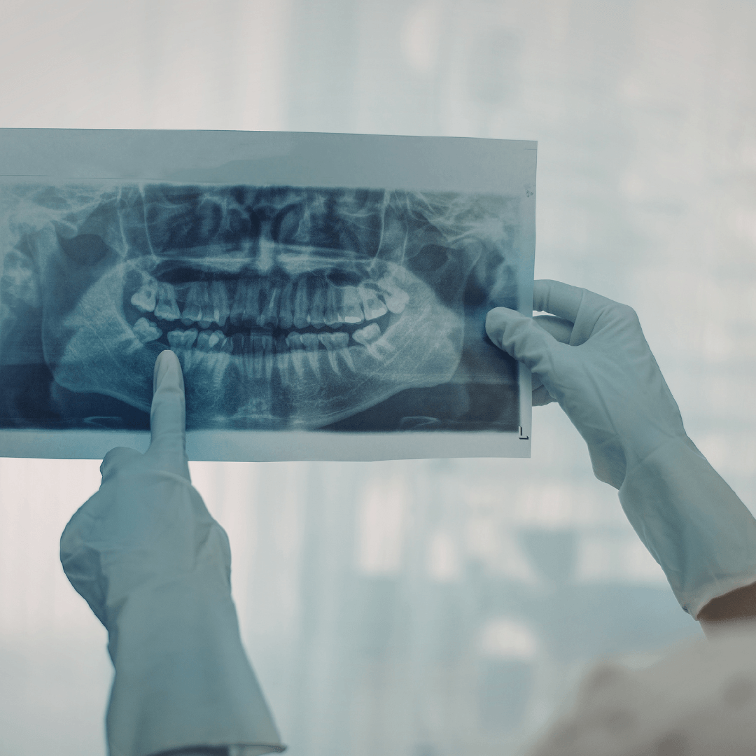Endodoncia y periodoncia