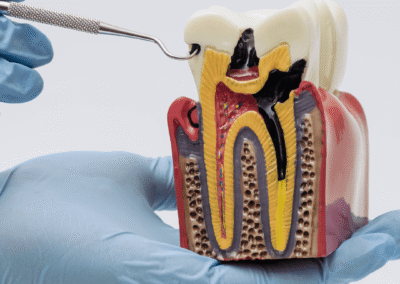 Endodoncia y Periodoncia